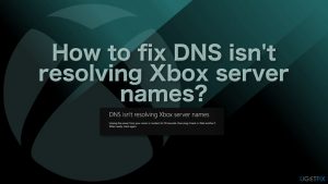 How to fix dns isnt resolving xbox server names