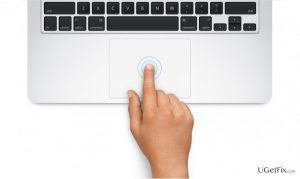 Trackpad issue